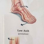 High Arch – Low Arch_11zon
